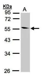 Anti-Coronin 1B antibody [N1N3] used in Western Blot (WB). GTX106831