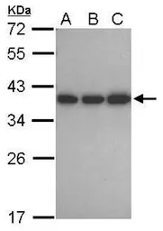 Anti-CAPZA1 antibody [N2C3] used in Western Blot (WB). GTX106832