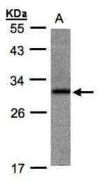 Anti-ANKRD7 antibody [N1C3] used in Western Blot (WB). GTX106843