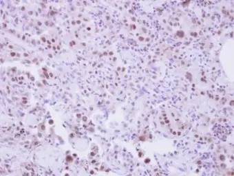 Anti-SLU7 antibody used in IHC (Paraffin sections) (IHC-P). GTX106861