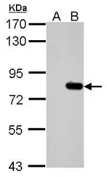 Anti-SLU7 antibody used in Western Blot (WB). GTX106861