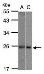Anti-MID1IP1 antibody used in Western Blot (WB). GTX106864