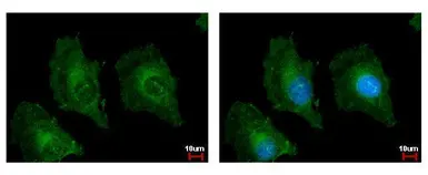 Anti-TSPAN3 antibody used in Immunocytochemistry/ Immunofluorescence (ICC/IF). GTX106868