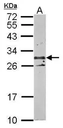 Anti-TSPAN3 antibody used in Western Blot (WB). GTX106868