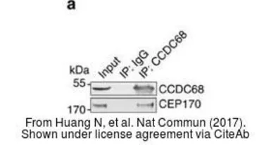 Anti-CCDC68 antibody [N2C3] used in Western Blot and Immunoprecipitation (WB IP). GTX106883