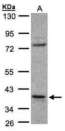 Anti-CCDC68 antibody [N2C3] used in Western Blot (WB). GTX106883