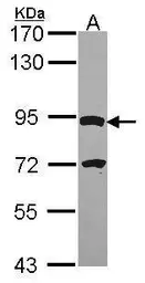 Anti-DPY19L4 antibody [C2C3], C-term used in Western Blot (WB). GTX106885