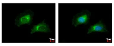 Anti-CARD6 antibody [N1N2], N-term used in Immunocytochemistry/ Immunofluorescence (ICC/IF). GTX106888