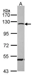 Anti-CARD6 antibody [N1N2], N-term used in Western Blot (WB). GTX106888