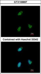 Anti-CLUAP1 antibody used in Immunocytochemistry/ Immunofluorescence (ICC/IF). GTX106897