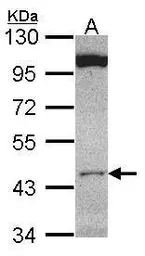Anti-CLUAP1 antibody used in Western Blot (WB). GTX106897