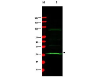 Anti-MAD2L1 antibody [17D10] used in Western Blot (WB). GTX10691