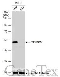 Anti-TXNDC5 antibody used in Western Blot (WB). GTX106914
