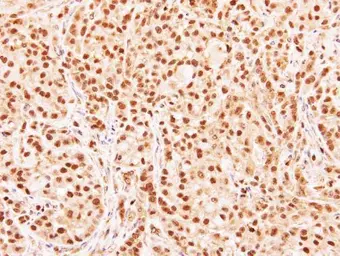 Anti-RG9MTD3 antibody [N2C3] used in IHC (Paraffin sections) (IHC-P). GTX106918