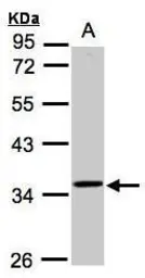 Anti-RG9MTD3 antibody [N2C3] used in Western Blot (WB). GTX106918