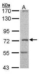 Anti-DNAI2 antibody [C1C3] used in Western Blot (WB). GTX106924