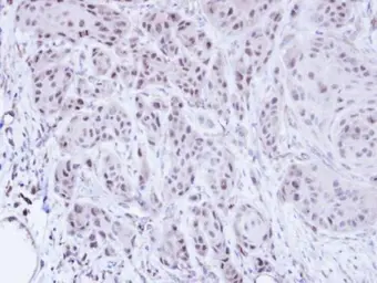 Anti-SCMH1 antibody [N1N3] used in IHC (Paraffin sections) (IHC-P). GTX106946