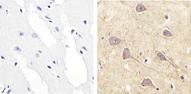 Anti-p90 RSK1 (phospho Ser221) antibody used in IHC (Paraffin sections) (IHC-P). GTX10695