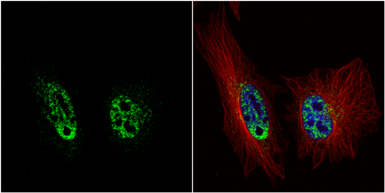 Anti-PRP19 antibody [C1C3] used in Immunocytochemistry/ Immunofluorescence (ICC/IF). GTX106952