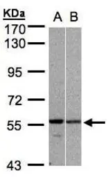Anti-PRP19 antibody [C1C3] used in Western Blot (WB). GTX106952