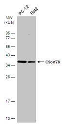 Anti-C9orf78 antibody [N1C2] used in Western Blot (WB). GTX106966