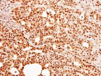 Anti-C9orf78 antibody [N1C2] used in IHC (Paraffin sections) (IHC-P). GTX106966