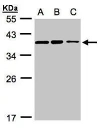 Anti-C9orf78 antibody [N1C2] used in Western Blot (WB). GTX106966