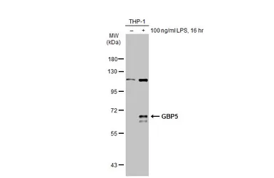 Anti-GBP5 antibody [N1N3] used in Western Blot (WB). GTX106994
