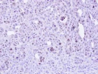 Anti-ZC3H8 antibody [N1C3] used in IHC (Paraffin sections) (IHC-P). GTX107008