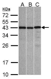 Anti-ZC3H8 antibody [N1C3] used in Western Blot (WB). GTX107008