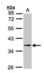 Anti-BXDC1 antibody [N1C2] used in Western Blot (WB). GTX107021