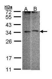 Anti-FHL5 antibody [N1C2] used in Western Blot (WB). GTX107031