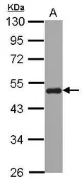 Anti-SNX5 antibody [N1C1] used in Western Blot (WB). GTX107045
