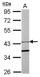 Anti-FBXO15 antibody [N1C1] used in Western Blot (WB). GTX107090