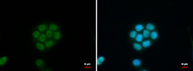 Anti-C11orf54 antibody used in Immunocytochemistry/ Immunofluorescence (ICC/IF). GTX107093