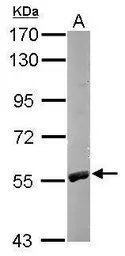 Anti-RCC2 antibody [N3C3] used in Western Blot (WB). GTX107094