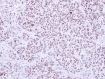 Anti-RCC2 antibody [N3C3] used in IHC (Paraffin sections) (IHC-P). GTX107094