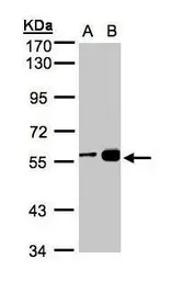 Anti-RCC2 antibody [N3C3] used in Western Blot (WB). GTX107094