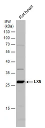 Anti-LXN antibody [N1C3] used in Western Blot (WB). GTX107116