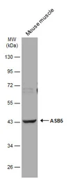 Anti-ASB5 antibody [N1C3] used in Western Blot (WB). GTX107132