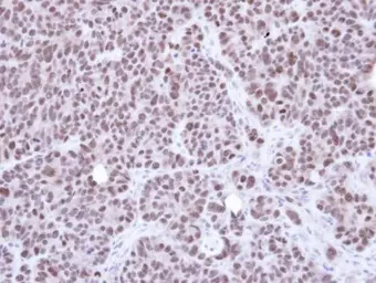Anti-NSMCE1 antibody [N1C3] used in IHC (Paraffin sections) (IHC-P). GTX107136