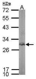 Anti-BPGM antibody [N1C3] used in Western Blot (WB). GTX107137