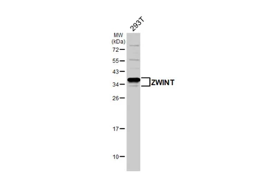 Anti-ZWINT antibody used in Western Blot (WB). GTX107155