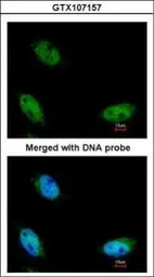 Anti-NSUN6 antibody [N3C3] used in Immunocytochemistry/ Immunofluorescence (ICC/IF). GTX107157
