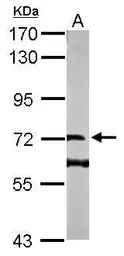 Anti-DENND1B antibody [N1C1] used in Western Blot (WB). GTX107160