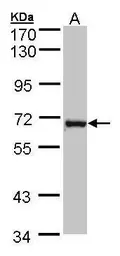 Anti-DENND1B antibody [N1C1] used in Western Blot (WB). GTX107160
