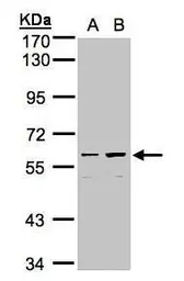 Anti-CCDC102B antibody [N3C3] used in Western Blot (WB). GTX107182