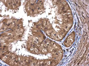 Anti-ART5 antibody [N1C3] used in IHC (Paraffin sections) (IHC-P). GTX107199
