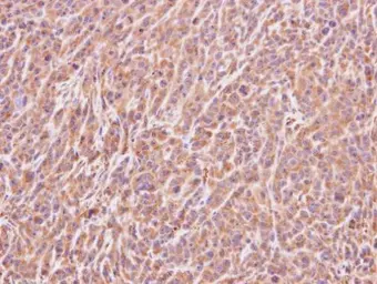 Anti-ART5 antibody [N1C3] used in IHC (Paraffin sections) (IHC-P). GTX107199