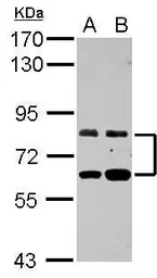 Anti-ZFP64 antibody used in Western Blot (WB). GTX107214